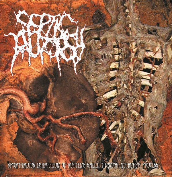 descargar álbum Septic Autopsy - Spontaneous Emanation Of Rotting Smell Through Necropsy Process