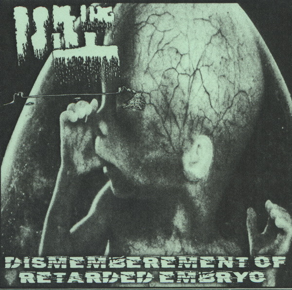 last ned album Boiling Point - Dismemberment Of Retarded Embryo