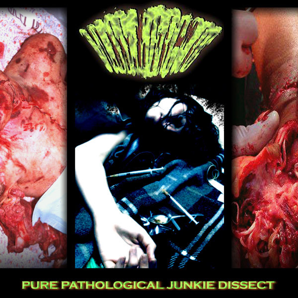 télécharger l'album Massakergore - Pure Pathological Junkie Dissect