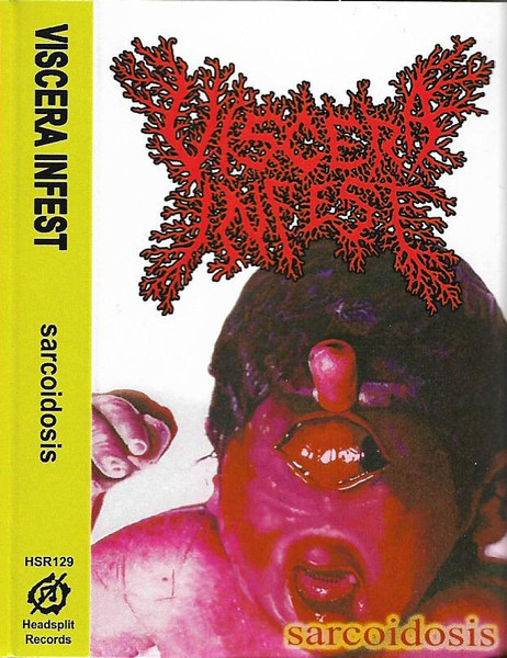 Viscera Infest – Sarcoidosis (CD) - Discogs