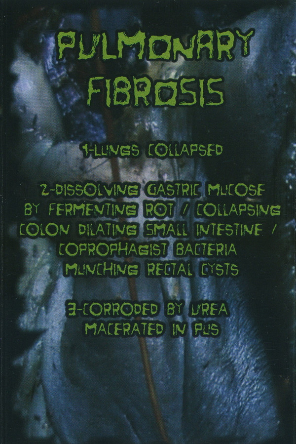 Album herunterladen Vomitoma Pulmonary Fibrosis - Vomitoma Pulmonary Fibrosis