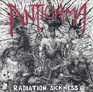 Antigama - Radiation Sickness / 13 Stabwounds: Contemplating Death