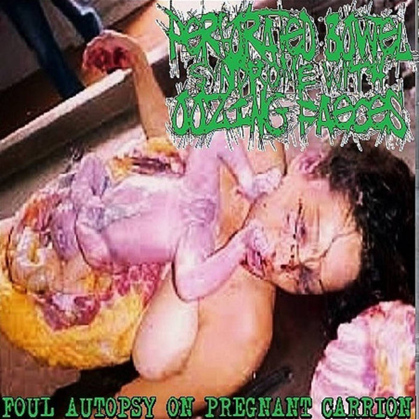 pregnant autopsy photos