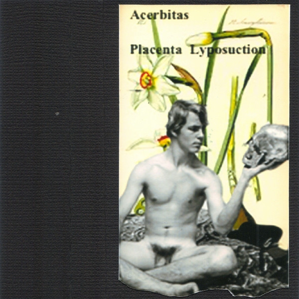 lataa albumi Acerbitas Placenta Lyposuction - Acerbitas Placenta Lyposuction