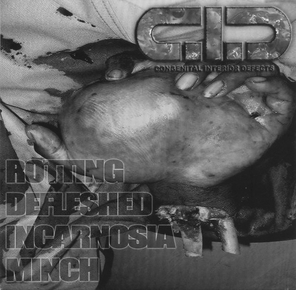 Album herunterladen Congenital Interior Defects Urine Festival - Rotting Defleshed Incarnosia Minch Enfluxorgasmic Engorged Climax