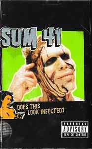 Sum 41 – Does This Look Infected? (2002
