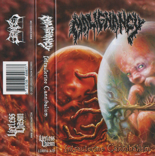 Malignancy – Intrauterine Cannibalism (2020, Cassette) - Discogs