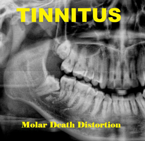 descargar álbum Tinnitus - Molar Death Distortion