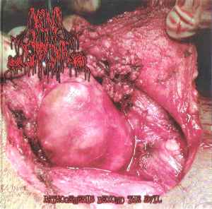 Carcinosarcoma - Pathogenesis Beyond The Evil album cover