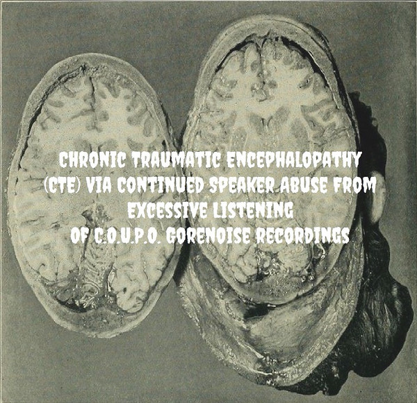 télécharger l'album Carcinomas Of Unknown Primary Origin - Chronic Traumatic Encephalopathy Cte Via Countinued Speaker Abuse From Excessive Listening Of C O U P O Gorenoise Recordings